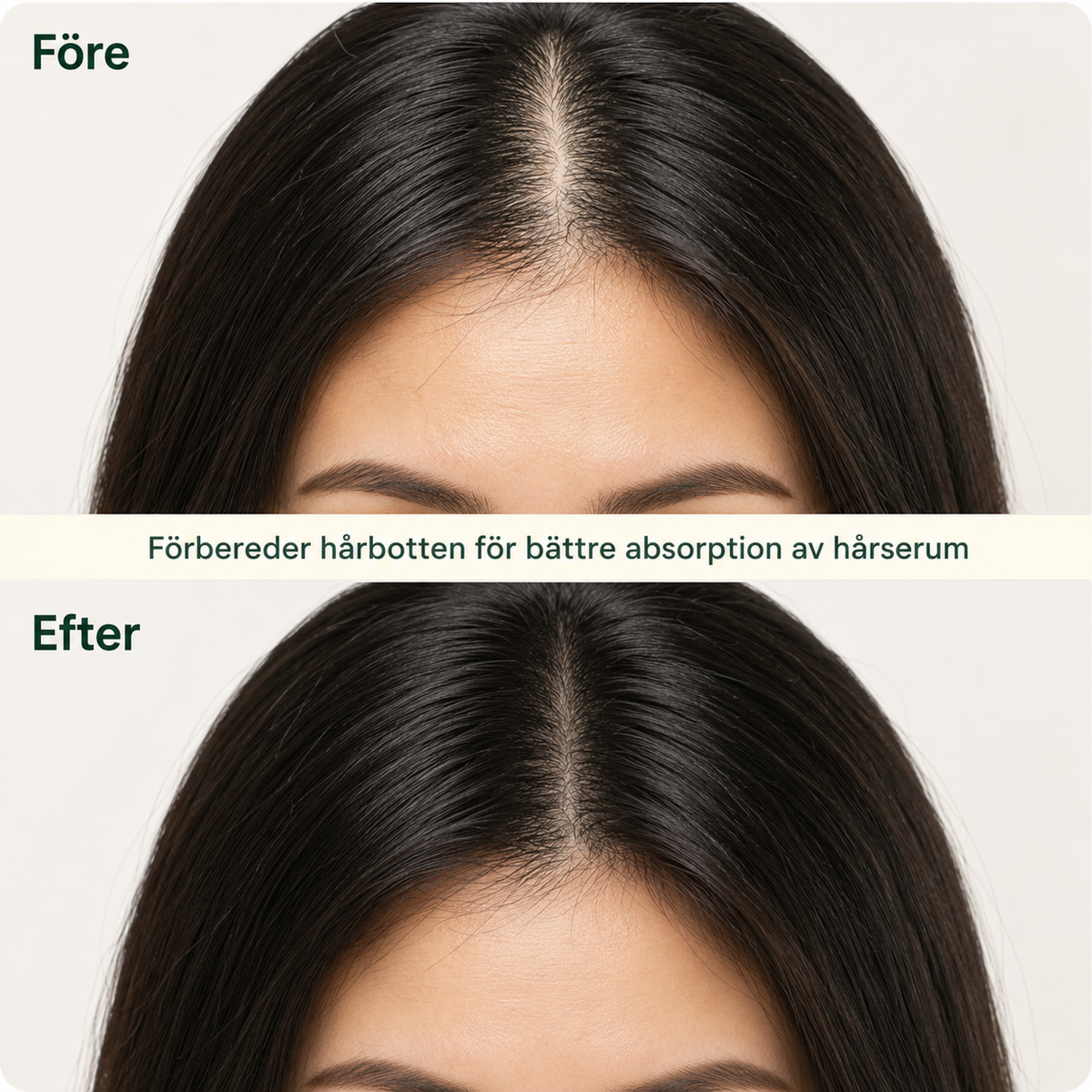 Örtkur — Koreansk Hårbottenbar